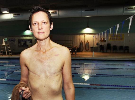 Breast cancer survivor with short hair standing topless by indoor swimming pool with lane dividers